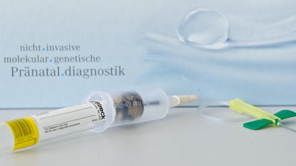 <p>Der NIP-Test sollen über eine vorgeburtliche Blutentnahme Aufschluss über eine mögliche Erkrankung des Kindes an Trisomie 21 geben.</p>