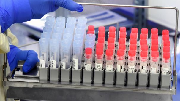 <p>SARS-CoV-2-Proben in einem PCR-Analysegerät.</p>