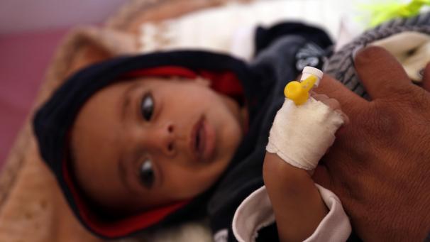 <p>Ein mit Malaria infiziertes jemenitisches Kind wird in einem Krankenhaus behandelt.</p>