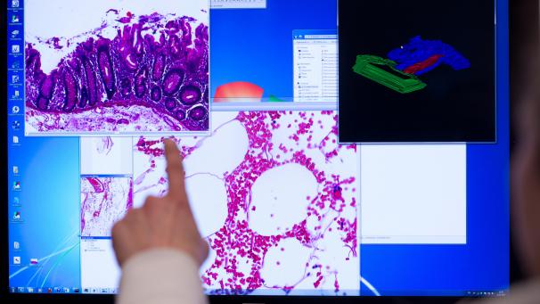 <p>Im Jahr 2020 wurden in Belgien 4.000 Krebsdiagnosen weniger verzeichnet als eigentlich erwartet.</p>