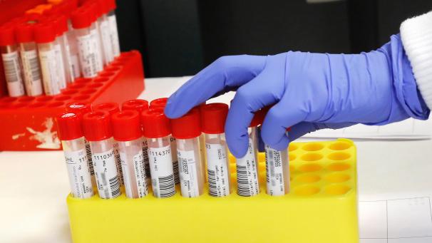<p>Ein Mikrobiologe untersucht in einem Labor Proben für PCR-Tests, um mit diesen festzustellen, ob eine Corona-Infektion vorliegt.</p>