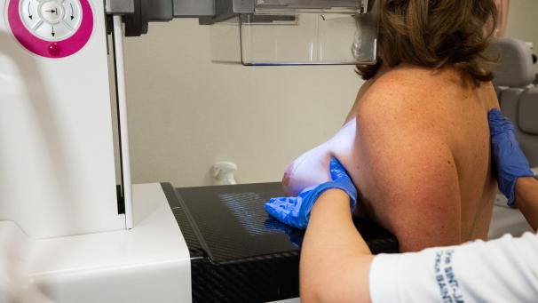 <p>Einen hundertprozentigen Schutz vor Brustkrebs gibt es leider nicht. In der Deutschsprachigen Gemeinschaft erkrankt etwa jede zehnte Frau im Laufe ihres Lebens an Brustkrebs. In Belgien ist Brustkrebs sogar mit Abstand die häufigste Krebserkrankung bei Frauen.</p>