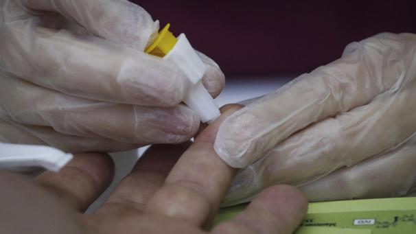 <p>Ein Mensch unterzieht sich einem HIV-Test.</p>