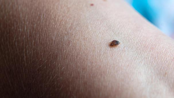 <p>Bettwanzen sind nachtaktiv und Meister im Verstecken.</p>