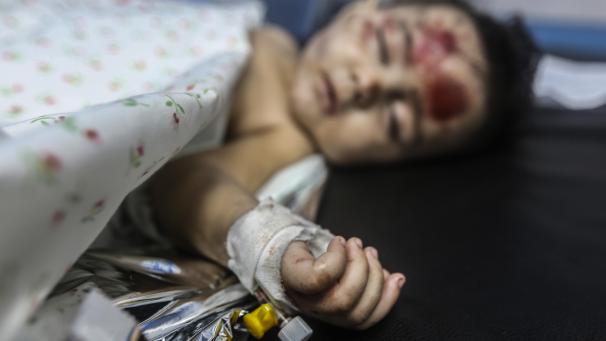 <p>Ein palästinensisches Kind liegt im Al-Schifa-Krankenhaus, nachdem es bei einem israelischen Angriff auf Gaza-Stadt schwere Verletzungen erlitten hat.</p>