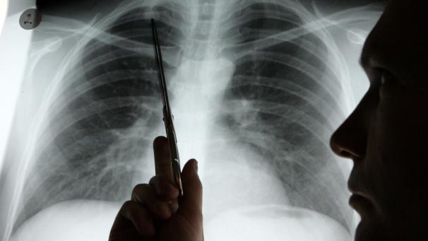 <p>Diagnose Lungenkrebs</p>