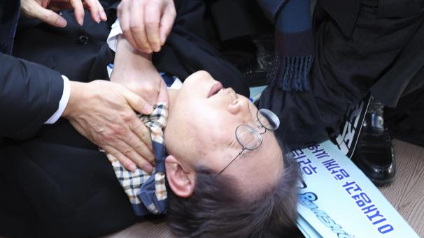 <p>Lee Jae Myung wird nach der Attacke behandelt.</p>