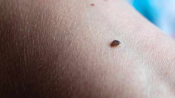 <p>Eine Bettwanze beißt in einen Arm: In Frankreich gibt es Aufregung um die Verbreitung von Bettwanzen.</p>