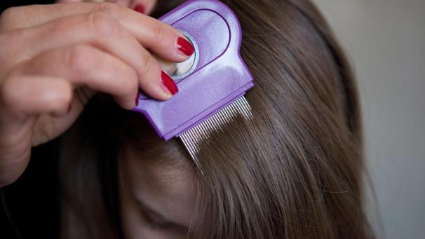 <p>Kopfläuse wird man am besten mit Haarpflegespülung und einem Läusekamm los.</p>