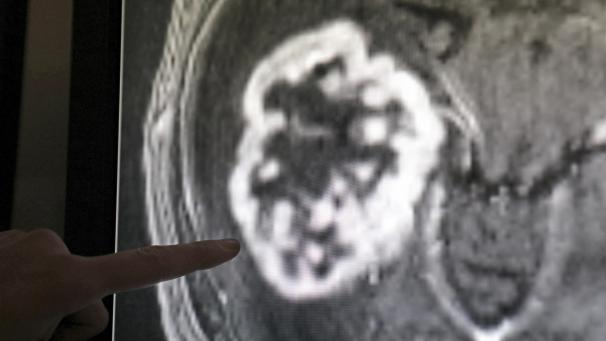 <p>Die Krebsdiagnose soll in Belgien in den kommenden Jahren verbessert werden.</p>