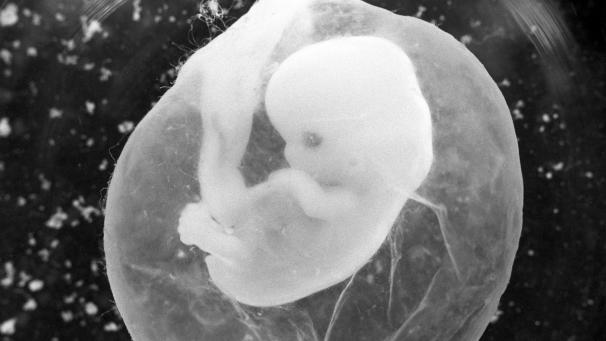 <p>Ein sieben Wochen alter Fötus in einer Fruchtblase. Die Grünen haben einen Gesetzesvorschlag im Parlament eingereicht, der eine Verlängerung der Abtreibungsfrist von 12 auf 18 Wochen vorsieht.</p>