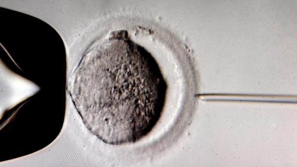 <p>Die Erfolgschancen einer künstlichen Befruchtung schwanken deutlich.</p>