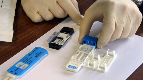 <p>Einige Drogen können mit einem klassischen Speicheltest nicht nachgewiesen werden. Ein neues Verfahren soll nun Abhilfe schaffen.</p>