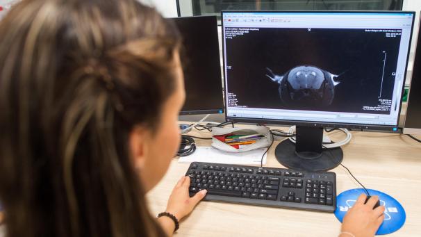 <p>Die Forscher untersuchten die Gehirnfunktion der Freiwilligen.</p>