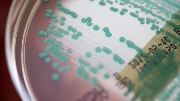 <p>Eine Petrischale mit MRSA-Keimen: Dass Antibiotika nicht mehr wirken, wird für die Menschheit zunehmend zum Problem. Forscher legen eine Prognose zur künftigen Entwicklung vor. Ihr Fazit: Es sind dringend neue Strategien nötig.</p>
