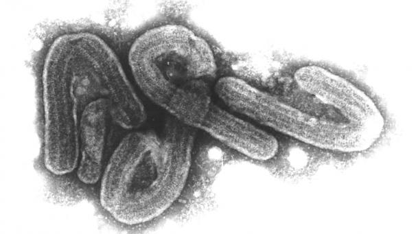 <p>Das Marburg-Virus gehört zu den gefährlichsten bekannten Krankheitserregern.</p>